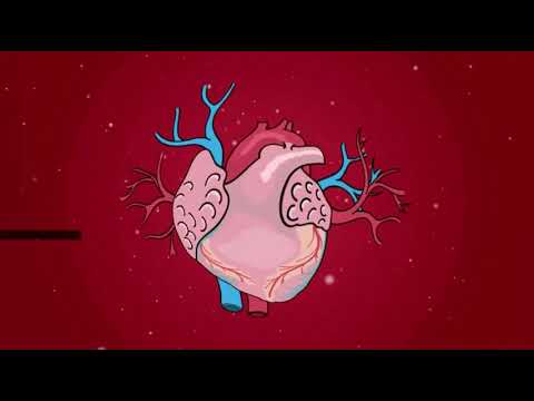 Transcatheter. aortic- valve replacement with a balloon- expandable valve in low- risk patients