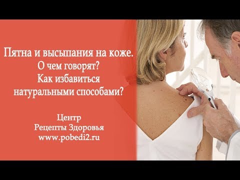 Маска для лица отбеливающая от витекс отзывы Молочная сыворотка и пигментные пятна