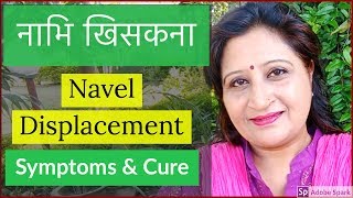 Navel Displacement Treatment | Navel Dislocation | Nabhi Treatment