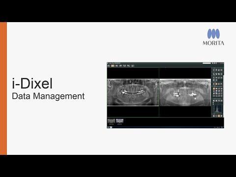 How to manage and move data around with i-Dixel