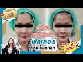เมโสแฟต ยี่ห้อไหนดี