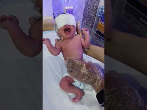 NNJ Baby Under Phototherapy – NICU Care #baby #neonatalcare #nicubaby #polydactyly #nicunurse