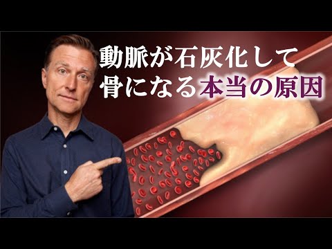 大動脈石灰化：その正体、症状、治療