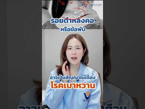 คลิกเพื่อดูคลิปวิดีโอ
