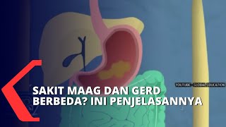 Download lagu Apa Perbedaan Maag dan Gerd Begini Penjelasannya... mp3