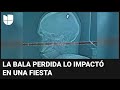 Joven Pasa Varios Días Con Una Bala En Su Cabeza Sin Darse Cuenta