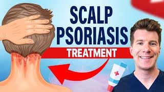 Doctor explains FOUR TREATMENTS for SCALP PSORIASIS