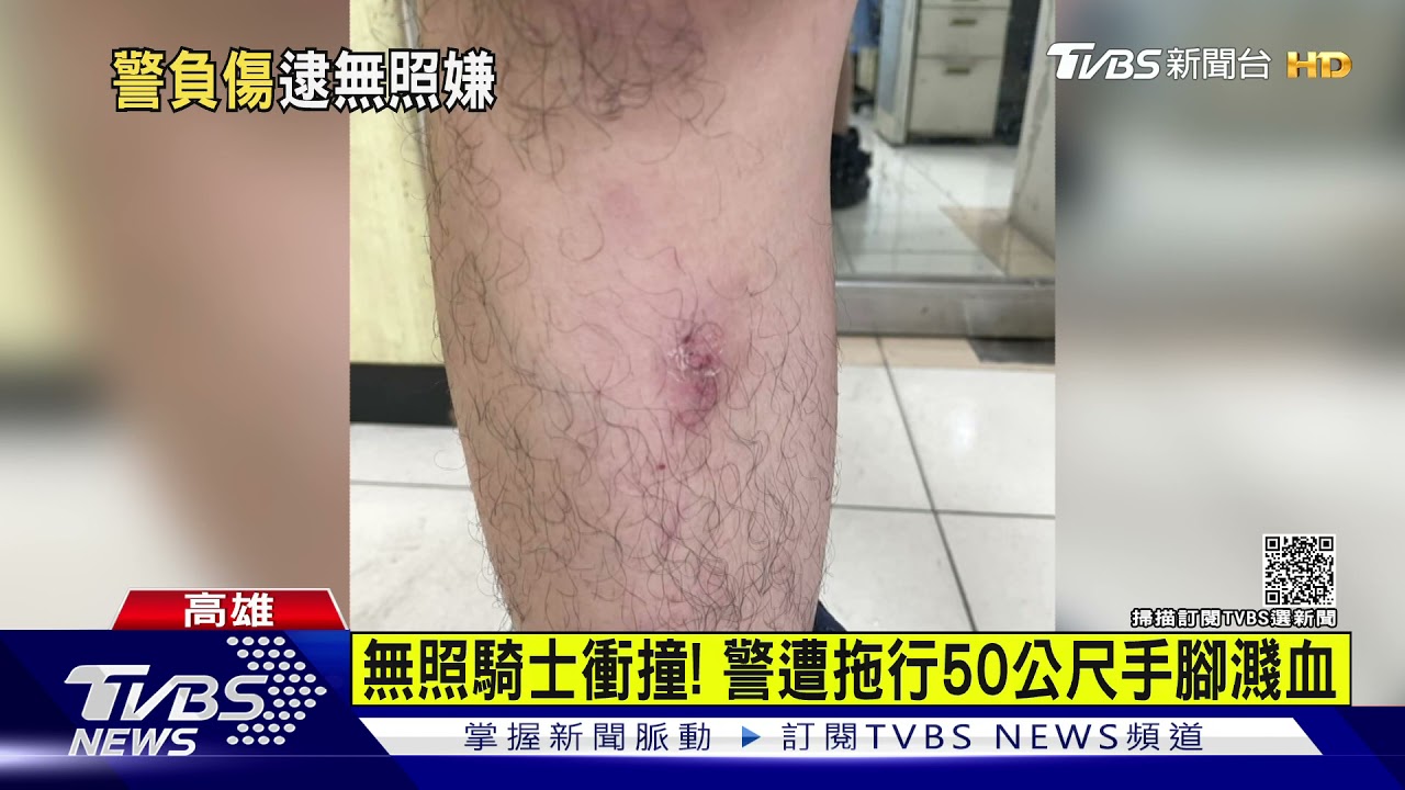 無照騎士衝撞!警遭拖行近50公尺手腳濺血