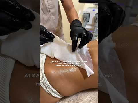 Santé Clínica Estética Barcelona