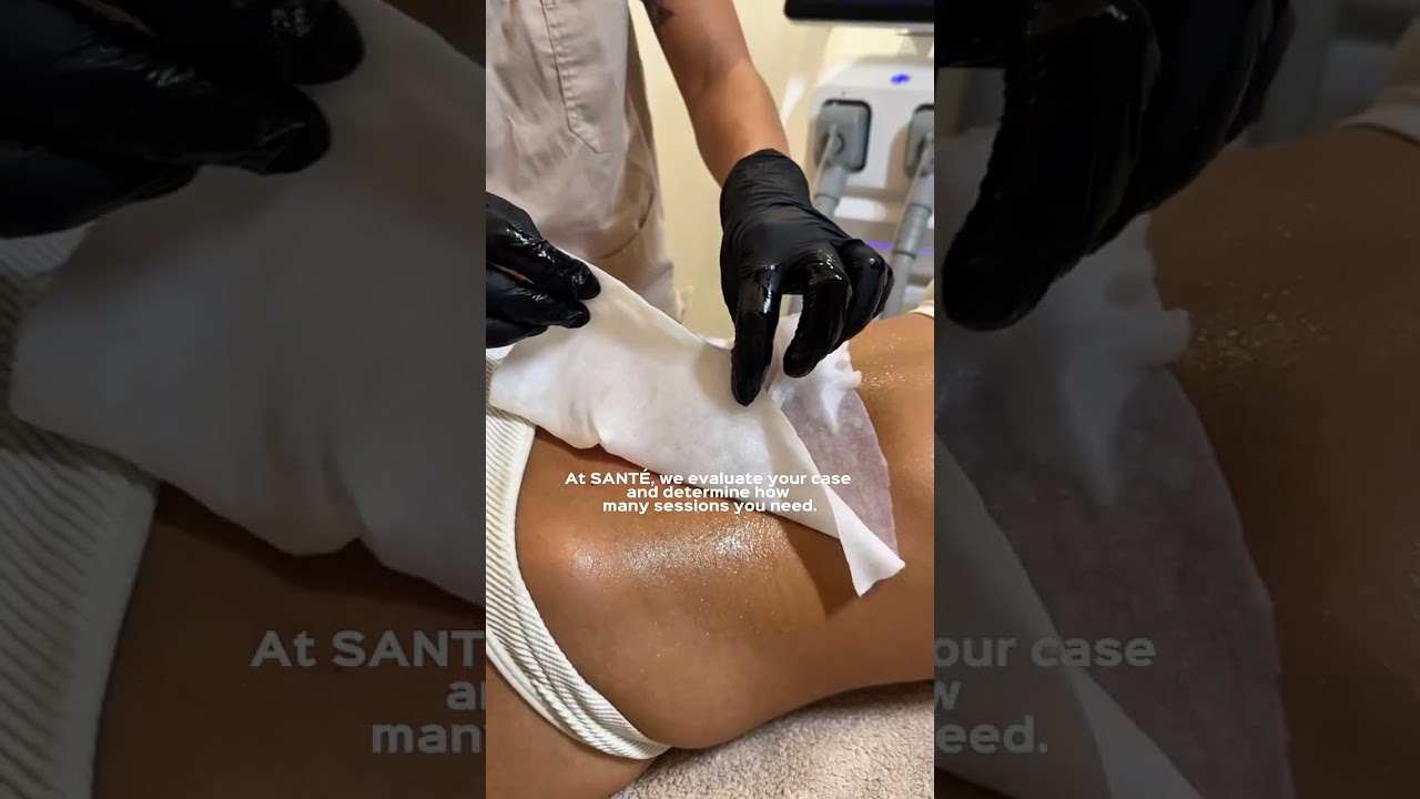 Santé Clínica Estética Barcelona