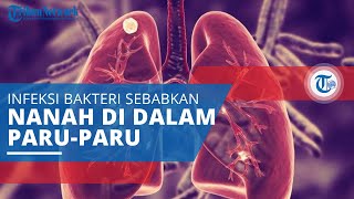 Abses Paru, Infeksi Bakteri yang Menyebabkan Adanya Kantong Berisi Nanah di Dalam Paru-paru
