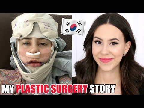 I GOT PLASTIC SURGERY IN KOREA || Double Jaw Surgery Experience Video