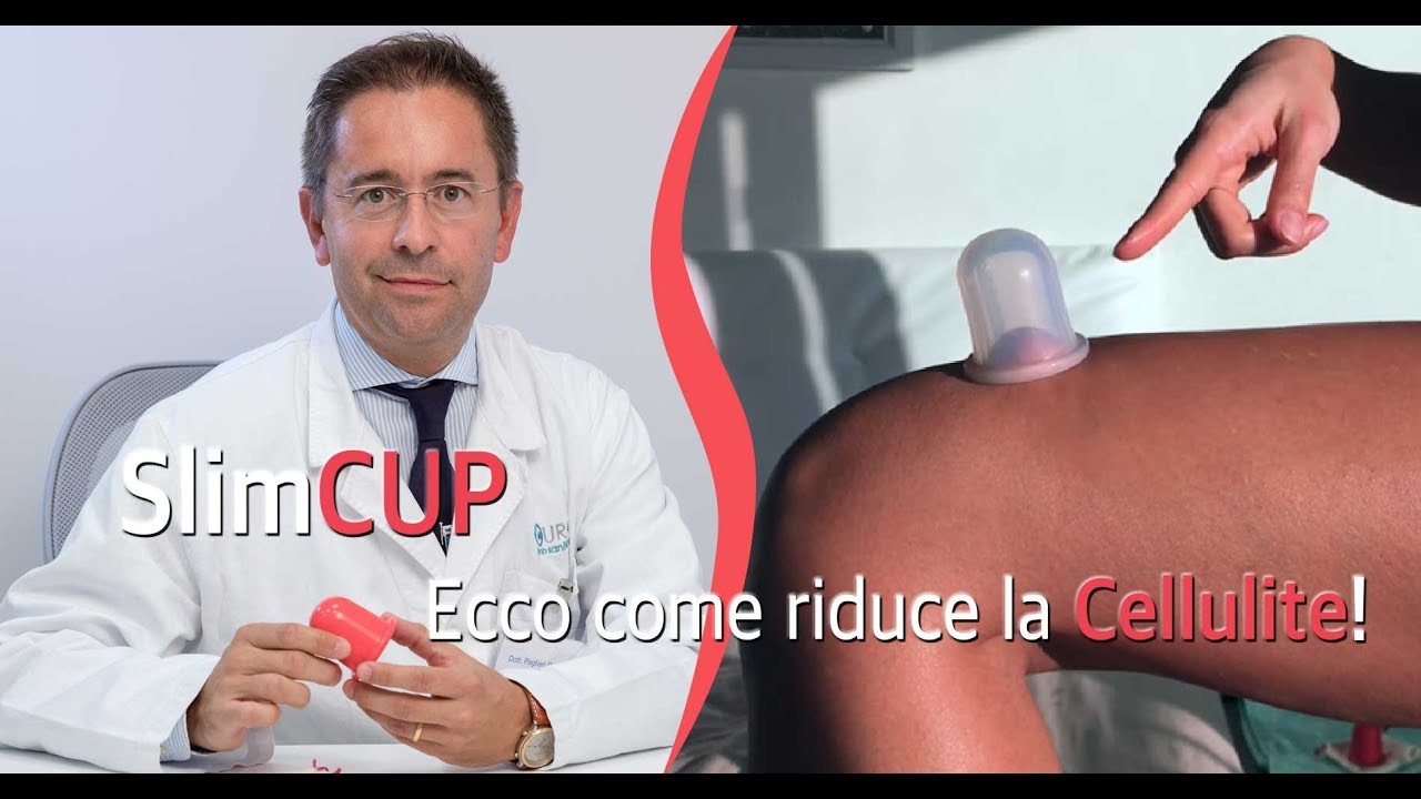 SlimCUP: Ecco come riduce la Cellulite