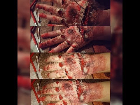 Əl üzərində qrim