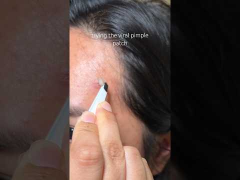best patches 🤭 hero cosmetics mighty patch! #pimplepatch #pimplepatches #pimplesremoval #skincare