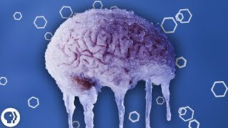 Why do You Get a Brain Freeze?