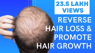 5 Easy Ways To Reverse Hair Loss &amp; Promote Hair Growth