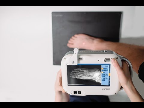 Europa Handheld X-Ray Product Overview