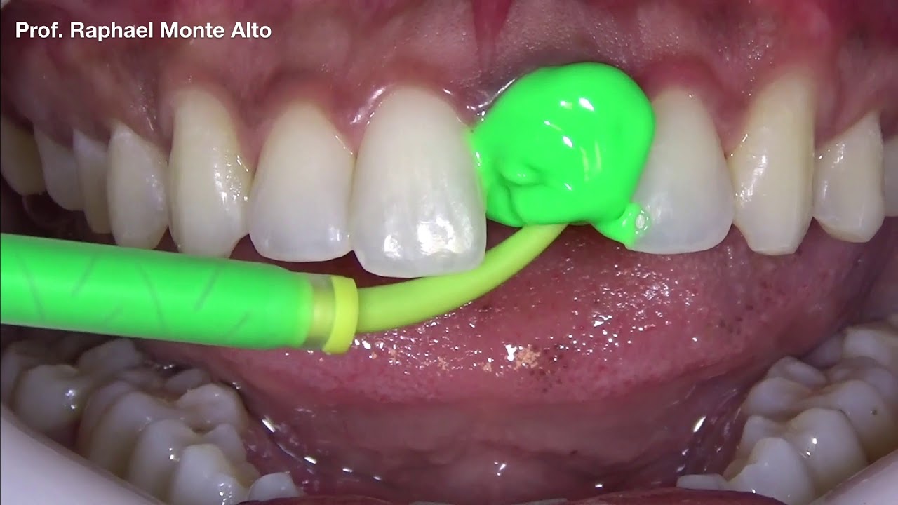 ¨Présentation President The Original