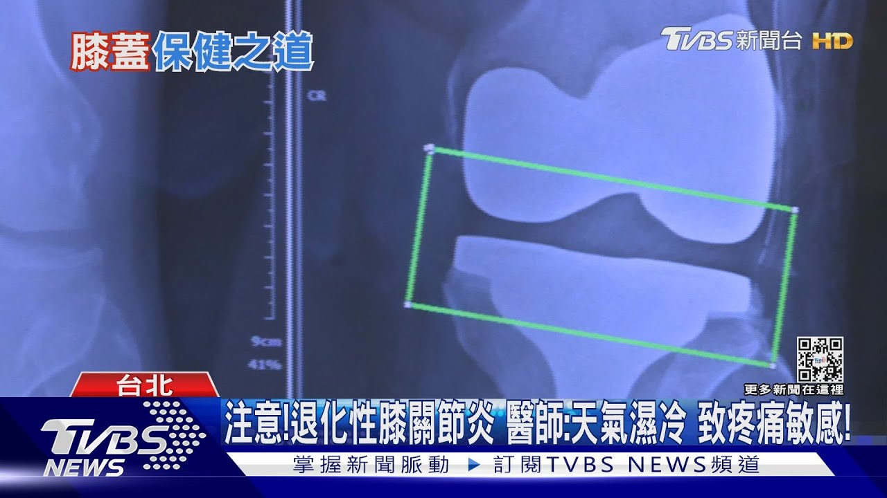 習慣這四種NG姿勢 加重「這部位」磨損痛起來要人命!