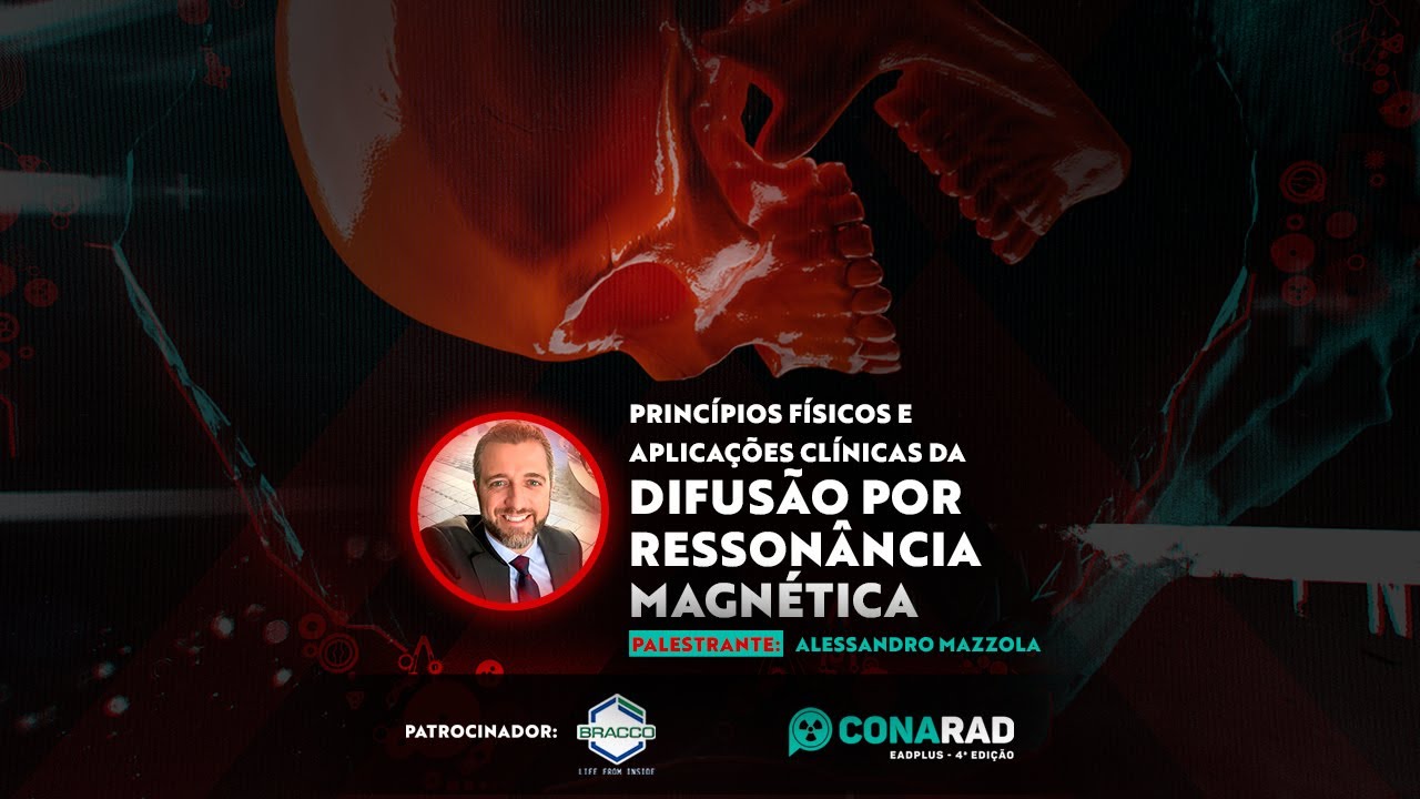 Princípios Físicos e Aplicações Clínicas da Difusão por Ressonância Magnética - Alessandro Mazzola