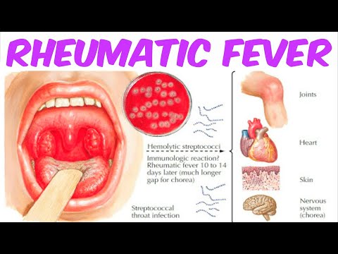 Rheumatic Fever!