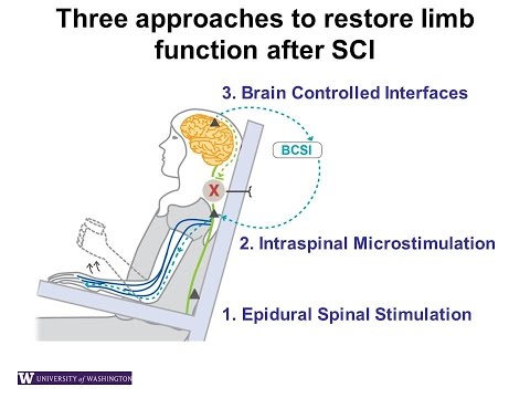 Restoring function after spinal cord injury: New research in ...