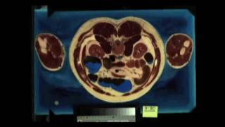 Meat Beat Manifesto - Return To Bass