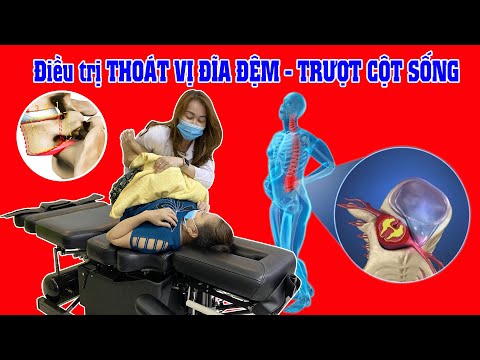 Điều trị THOÁT VỊ ĐĨA ĐỆM - TRƯỢT CỘT SỐNG - ĐAU THẦN KINH TỌA