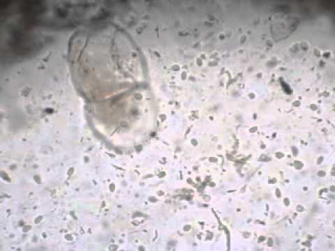 küldetés giardia