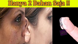 Download lagu 4 Menit !! Hilangkan Semua Masalah Wajah Hanya 2 Bahan || Dodi Satria mp3