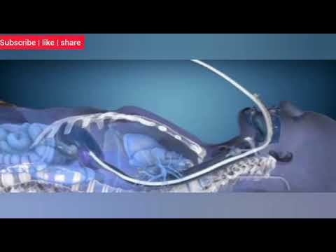 Advanced cooling therapy