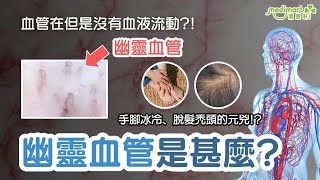 你有冇聽過「幽靈血管」？😱 知唔知會對身體帶嚟咩影響？ 唔理嘅話，隨時手腳麻痺、肌肉酸痛無力，甚至加速衰老！