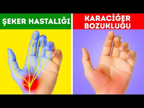 Ellerinizin Sizi Uyardığı 12 Sağlık Sorunu