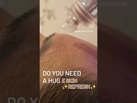 Hydra Facial at Beyond Aesthetics