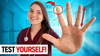 What your HANDS say about your HEALTH: Doctor Explains