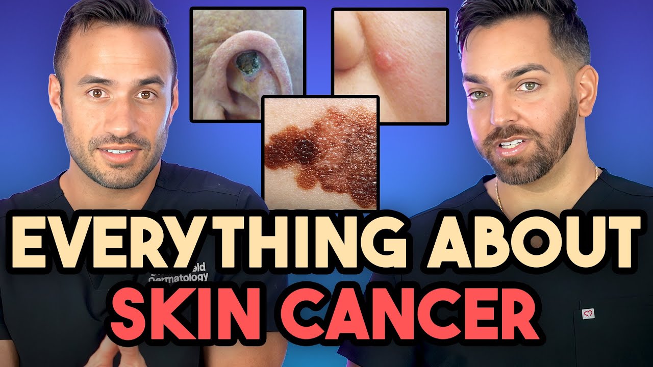 Everything About Skin Cancer: Prevent, Identify, Biopsy, and Treatment | Dermatologist Explains