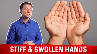 Stiff &amp; Swollen Hands Remedy