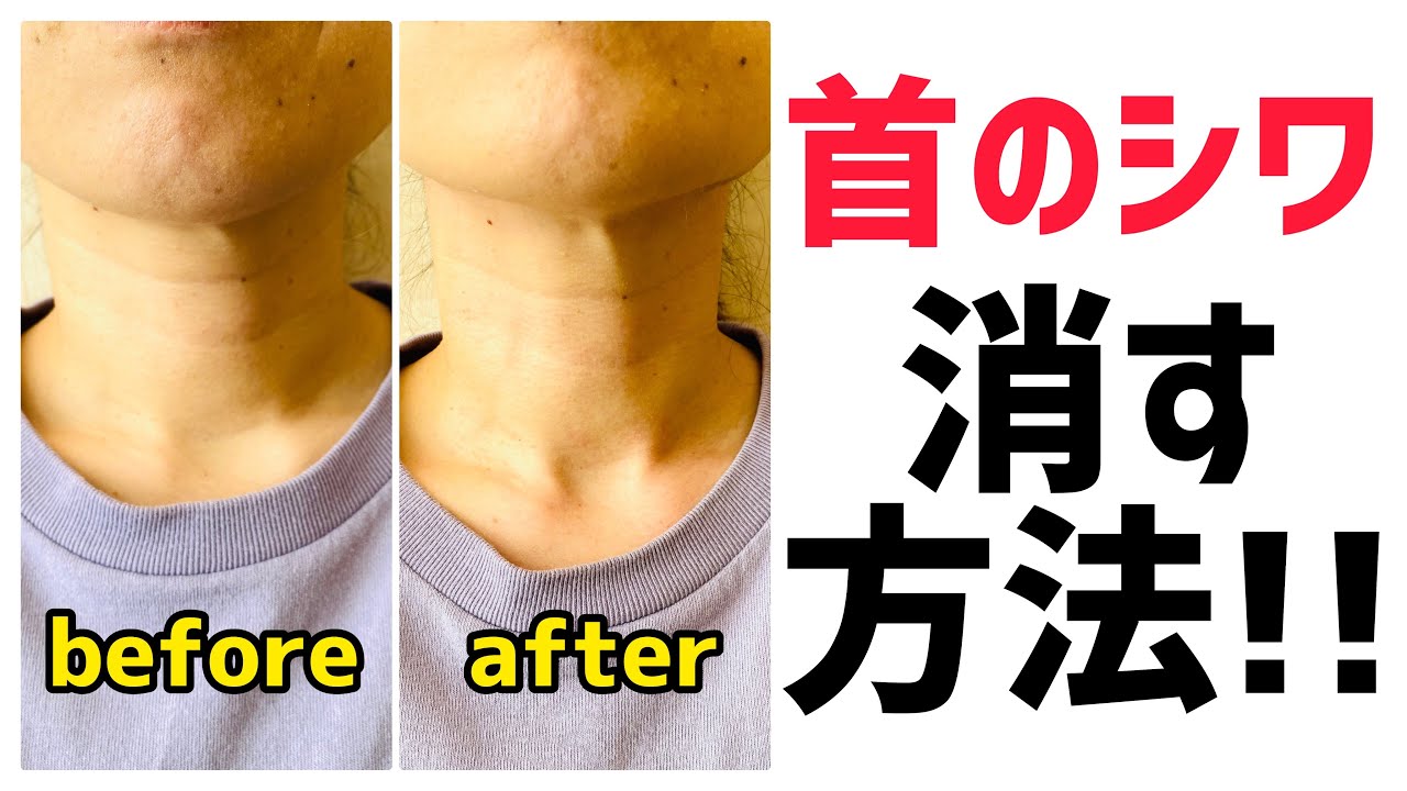 【スッキリ!!】首のシワを消す方法