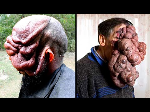 People with Extraordinarily Rare Body Parts