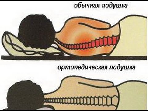 Шейном отделе позвоночника имеется у Ломота боли в суставах
