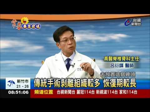 脊椎手術風險 微創精準手術大突破