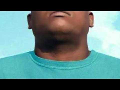 EL Micha Ft Narra Mc