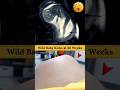 Fetal Movement In Mom S Belly Shortvideo Foryou