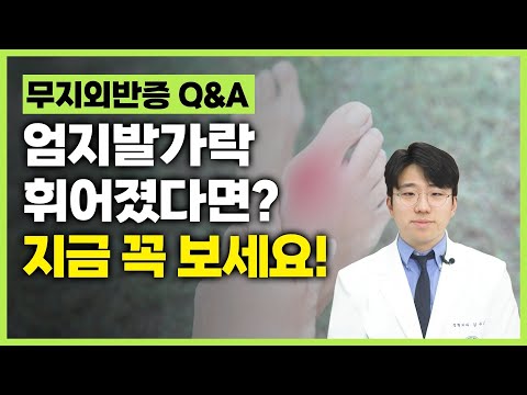 엄지발가락 휘어졌다면? 지금 꼭 보세요!