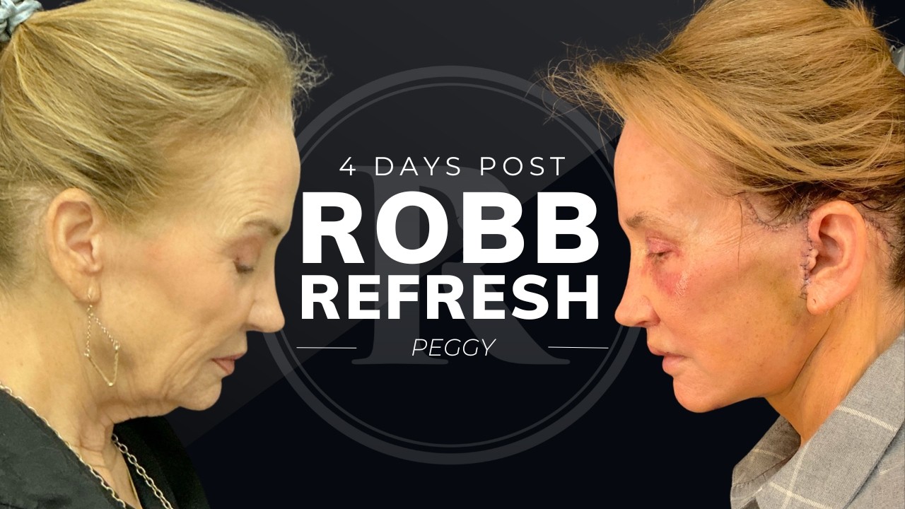 Robb Facial Plastic Surgery