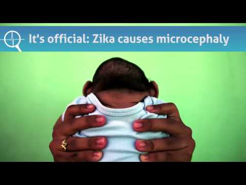 The Zika link: Small heads and brains
