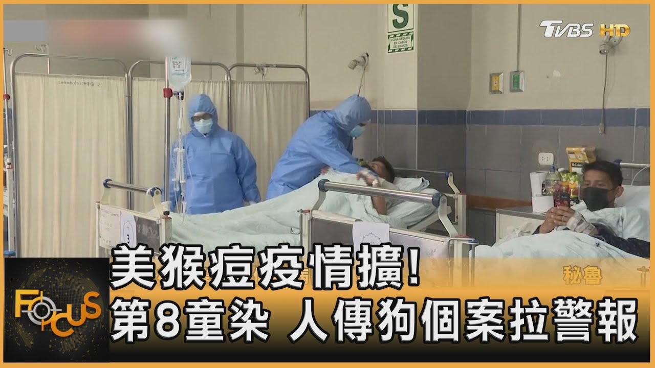 美猴痘疫情擴!第8童染.人傳狗個案拉警報