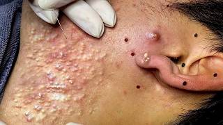 𝑺𝒐𝒐𝒕𝒉𝒊𝒏𝒈 𝑭𝒂𝒄𝒊𝒂𝒍 𝑻𝒓𝒆𝒂𝒕𝒎𝒆𝒏𝒕 𝑭𝒐𝒓 𝑺𝒕𝒓𝒆𝒔𝒔 𝑹𝒆𝒍𝒊𝒆𝒇 𝒂𝒕 𝑳𝒖𝒙𝒖𝒓𝒚 𝑺𝒑𝒂 𝑨𝒄𝒉𝒊𝒆𝒗𝒆 𝑰𝒏𝒏𝒆𝒓 𝑷𝒆𝒂𝒄𝒆 #500356