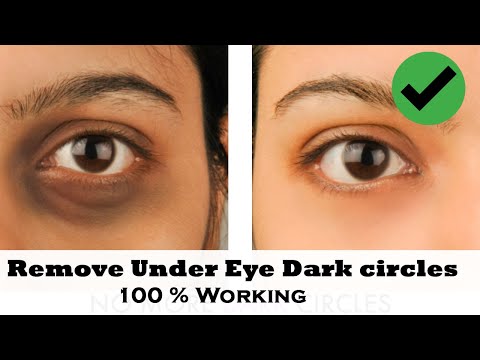 How to Remove Dark Spots Under Eyes at Home in 3 Days...